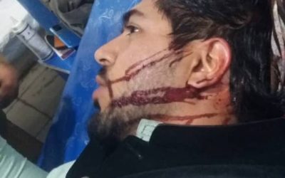 لت‌وکوب یک کارمند  شبکه تلویزیونی از سوی افراد مسلح ناشناس در کابل