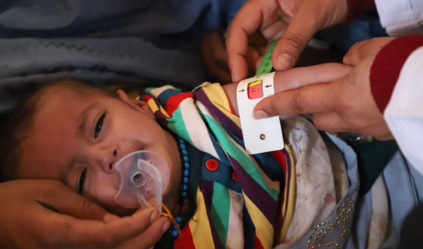 برنامه جهانی غذا: افزایش ابتلایان سوءتغذیه در افغانستان نگران کننده است